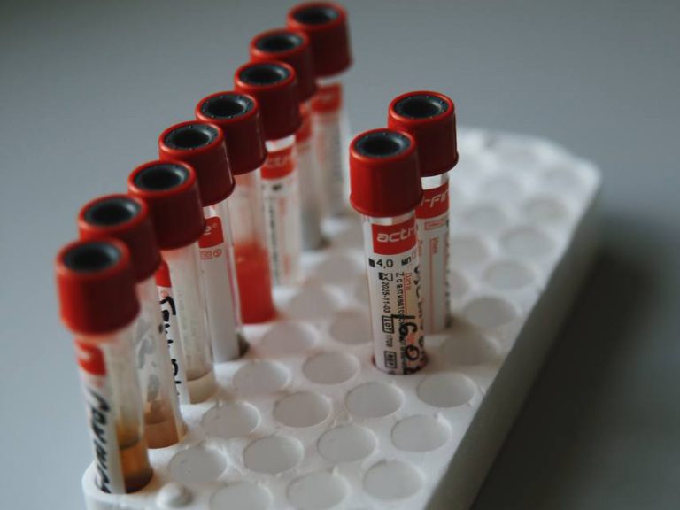 пробирки с кровью