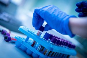 Кровь для сдачи в лаборатории